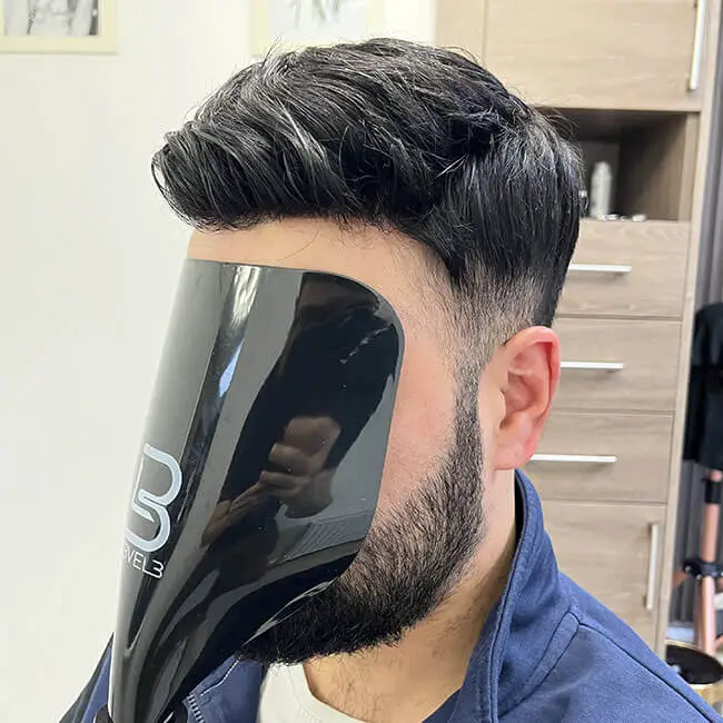 After Hair Replacement System Result