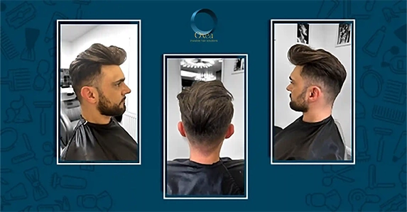 What To Consider Before Getting Hair Replacement Systems