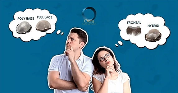 Guide To Help In Choosing Types Of Hair Systems