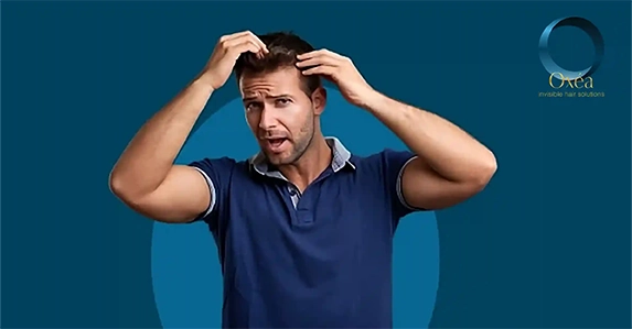 How To Control The Human Hair System Shedding?