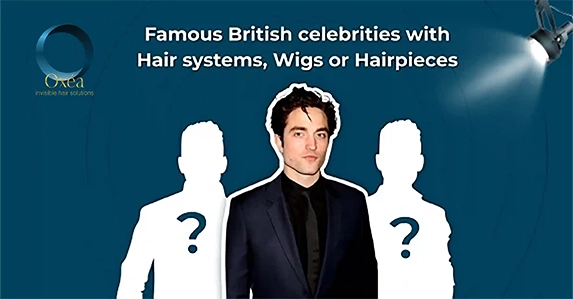 Famous British Celebrities With Hair Systems, Wigs Or Hairpieces
