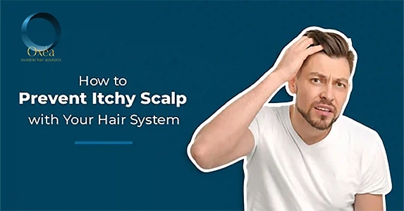 How To Prevent Itchy Scalp With Your Hair System