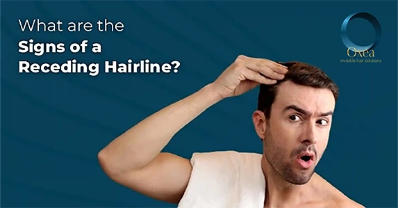 What Are The Signs Of A Receding Hairline?