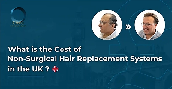 What is the cost of hair replacement