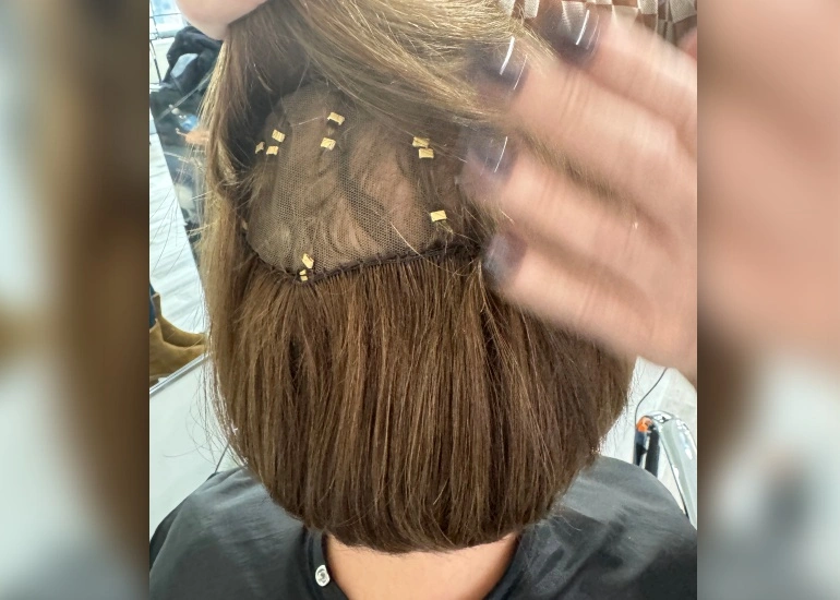 Mesh Integration Hair System For Hair Loss What is a mesh integration hair system