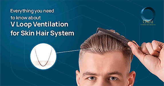 V Loop Ventilation For Skin Hair System