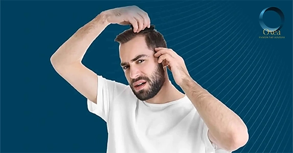 Risks of Ignoring Hair Loss Early On