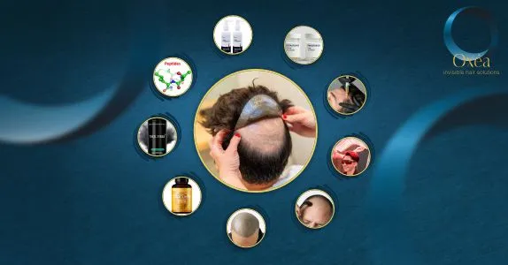 Top Non-Surgical Hair Loss Treatments