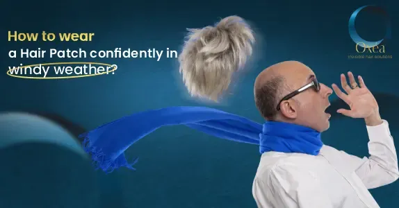 https://oxealondon.com/hair-replacement-system-in-london/