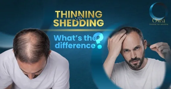 Thinning vs Shedding: What’s the Difference