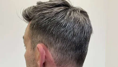 Restructuring of Hairpieces